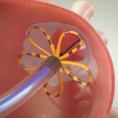 Scopri il sistema PFA e come funziona.