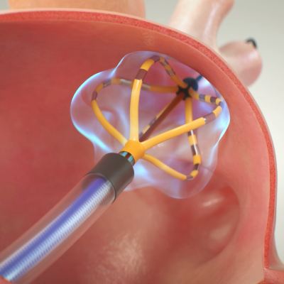 Scopri il sistema PFA e come funziona.